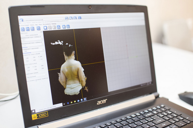 3D scanning of spine